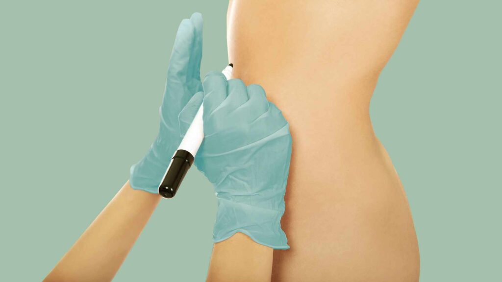 Chirurgia dermatologica estetica