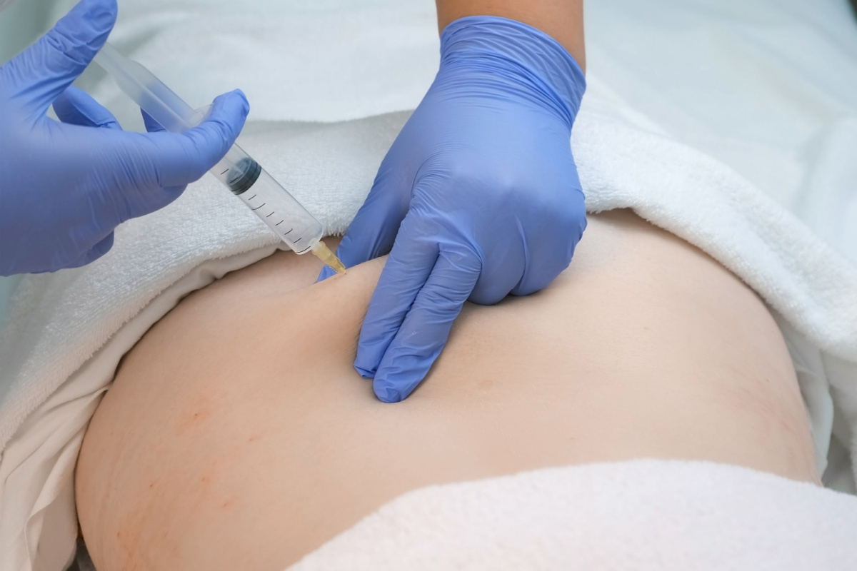 ozonoterapia e dolorosa